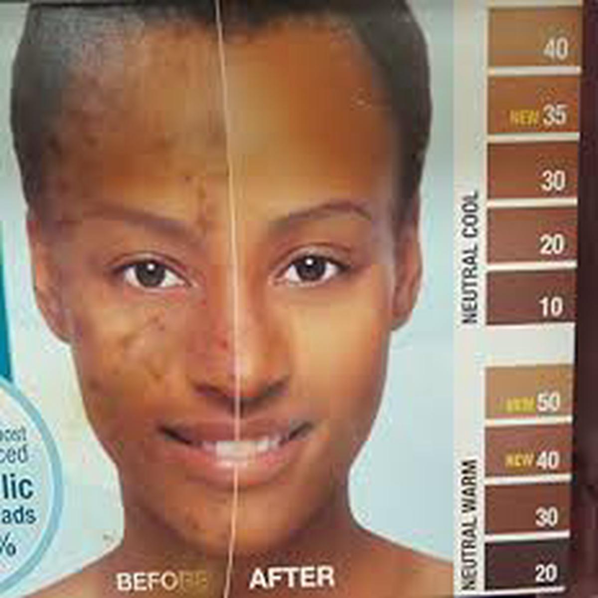 Cover + Care Acne Cover & Control Cream Foundation by Kiss